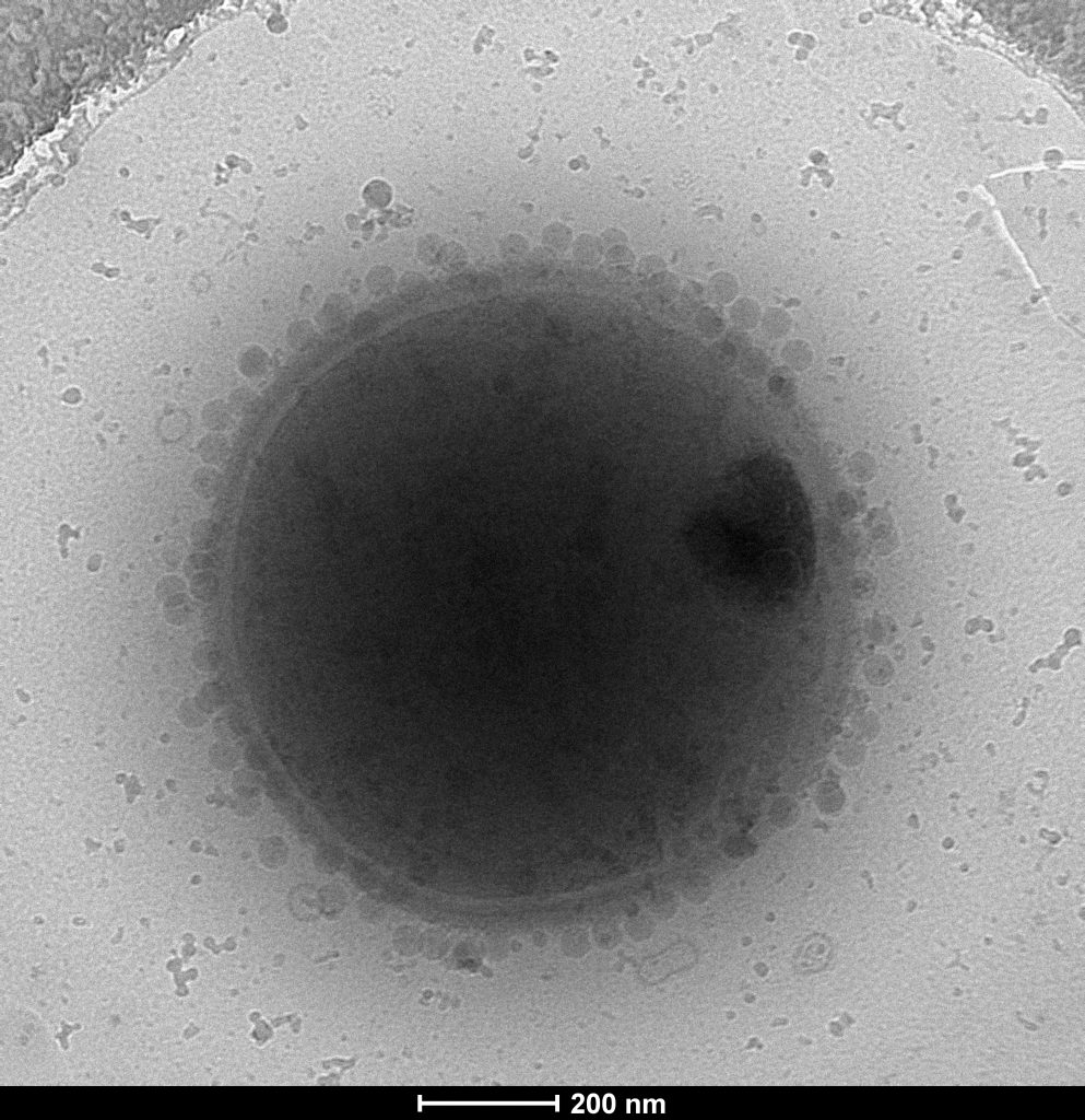Bakteriofág P68 napádajúci bunku Stafylokoka Zväčšenie 28 000-krát
